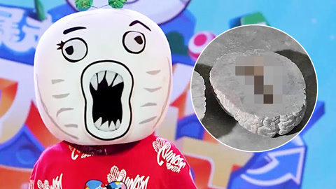 公车猥琐“顶族”大脑解剖后